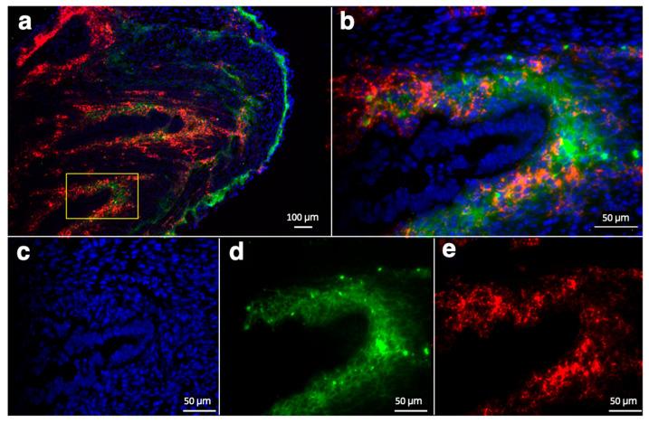 https://cdn.ncbi.nlm.nih.gov/pmc/blobs/837f/10856945/0768f4e5b68e/nanomaterials-14-00319-g006.jpg