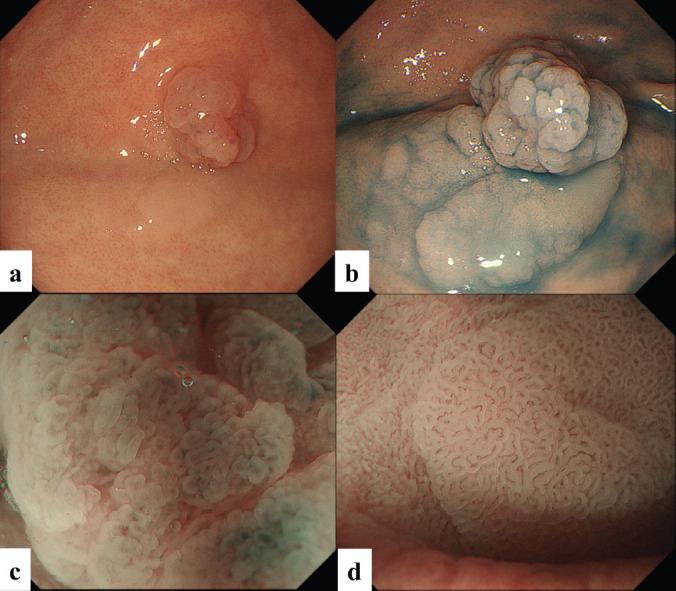 https://cdn.ncbi.nlm.nih.gov/pmc/blobs/838d/7738269/a4a8569791f5/can-14-1143fig1.jpg