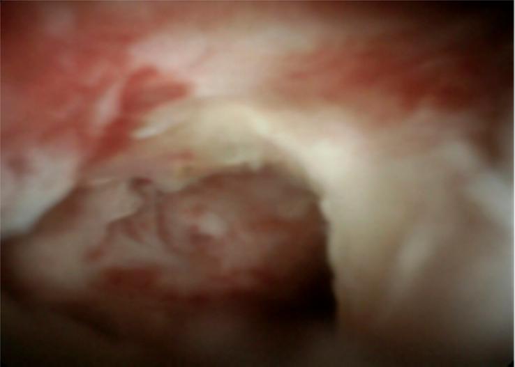 https://cdn.ncbi.nlm.nih.gov/pmc/blobs/838e/10990305/7fbe2fad727a/ms9-86-1867-g003.jpg