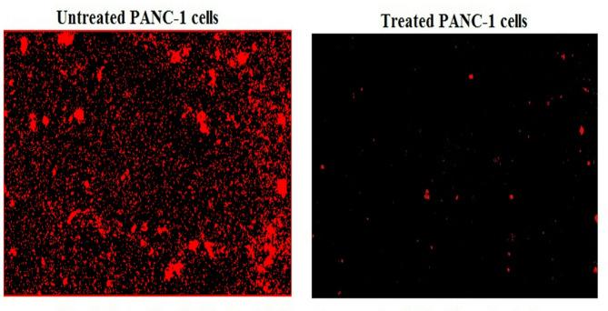 https://cdn.ncbi.nlm.nih.gov/pmc/blobs/8397/12181288/a0f22659db7b/41598_2025_5088_Fig5_HTML.jpg