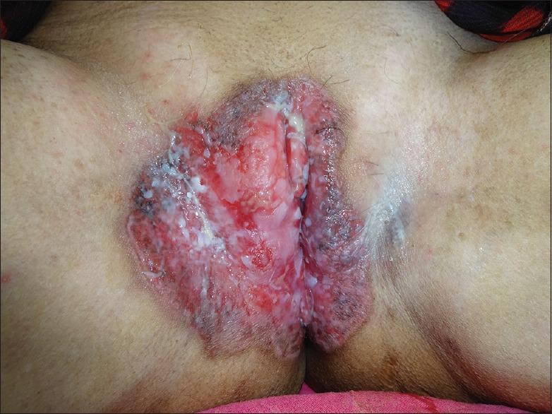 https://cdn.ncbi.nlm.nih.gov/pmc/blobs/839b/5389220/1e8611e333b3/IJSTD-38-76-g001.jpg