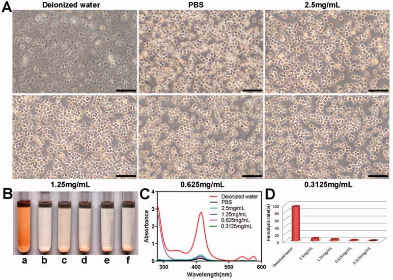 https://cdn.ncbi.nlm.nih.gov/pmc/blobs/839b/8856057/23969fd21b75/IDRD_A_2036871_F0006_C.jpg