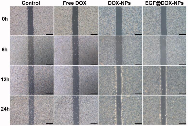 https://cdn.ncbi.nlm.nih.gov/pmc/blobs/839b/8856057/401e1420268a/IDRD_A_2036871_F0005_C.jpg