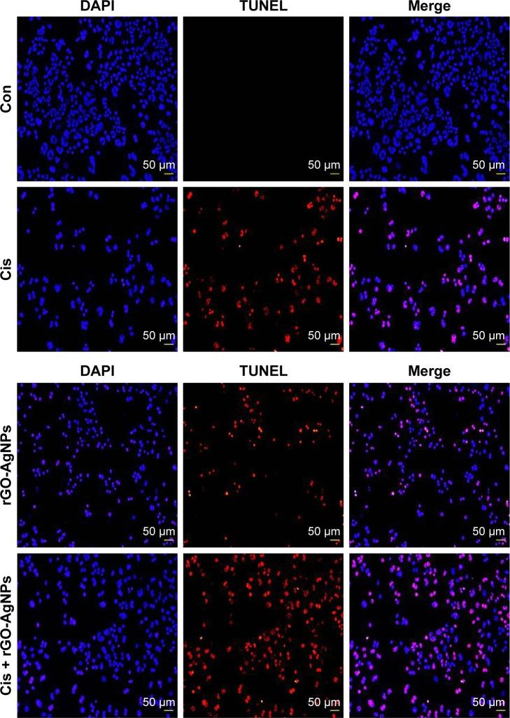 https://cdn.ncbi.nlm.nih.gov/pmc/blobs/839e/5592952/45b0412826f9/ijn-12-6537Fig12.jpg