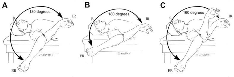 https://cdn.ncbi.nlm.nih.gov/pmc/blobs/83a2/3445082/08dbb6b5a2ec/10.1177_1941738110362518-fig1.jpg