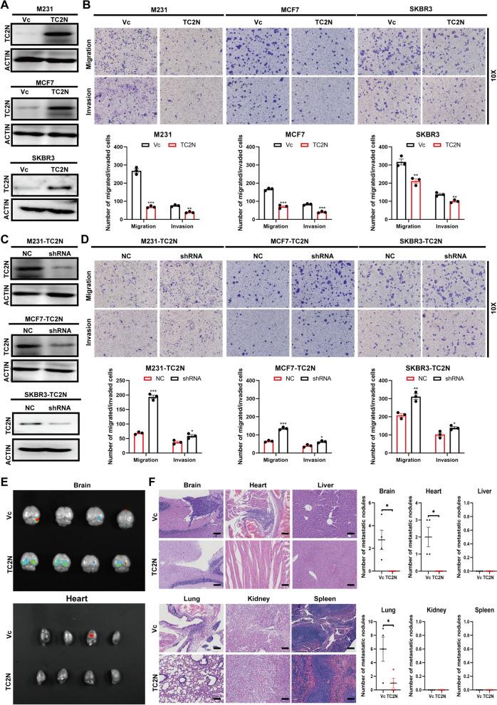 https://cdn.ncbi.nlm.nih.gov/pmc/blobs/83a4/10763294/8ed5c9cf35c0/12967_2023_4721_Fig2_HTML.jpg