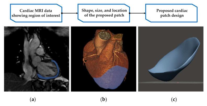 https://cdn.ncbi.nlm.nih.gov/pmc/blobs/83ac/8945185/9b3a77008a47/bioengineering-09-00093-g002.jpg