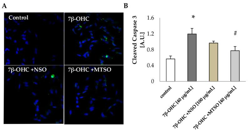 https://cdn.ncbi.nlm.nih.gov/pmc/blobs/83b2/8229989/30d66b611f6b/biomolecules-11-00797-g006.jpg