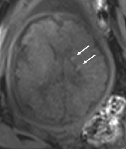 https://cdn.ncbi.nlm.nih.gov/pmc/blobs/83b3/2747421/a7b0f5cc79b9/IJRI-19-69-g003.jpg