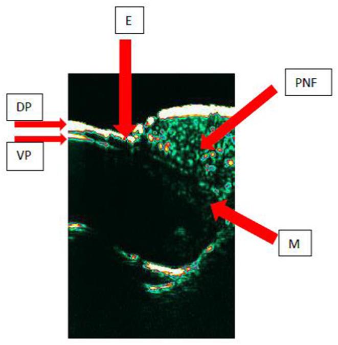https://cdn.ncbi.nlm.nih.gov/pmc/blobs/83c1/8236586/976d5256db5f/fmed-08-686470-g0001.jpg