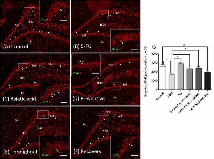 https://cdn.ncbi.nlm.nih.gov/pmc/blobs/83c4/5503269/4ce5fa9eb793/pone.0180650.g003.jpg