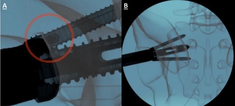 https://cdn.ncbi.nlm.nih.gov/pmc/blobs/83c7/11842032/555feb3221ee/cureus-0017-00000077793-i06.jpg