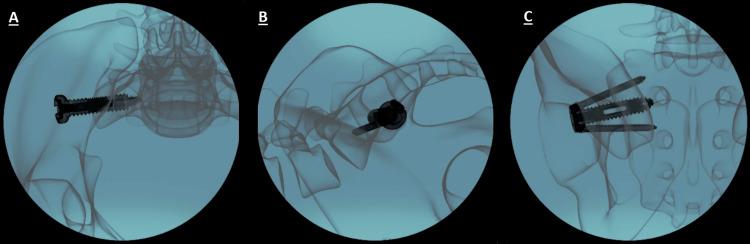 https://cdn.ncbi.nlm.nih.gov/pmc/blobs/83c7/11842032/ab3bb0cce687/cureus-0017-00000077793-i07.jpg