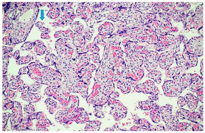 https://cdn.ncbi.nlm.nih.gov/pmc/blobs/83c7/9330733/201ff8c6827d/microorganisms-10-01497-g006.jpg
