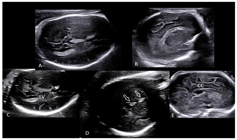 https://cdn.ncbi.nlm.nih.gov/pmc/blobs/83c7/9330733/4f643eb38ba0/microorganisms-10-01497-g001.jpg