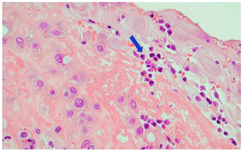 https://cdn.ncbi.nlm.nih.gov/pmc/blobs/83c7/9330733/603f37d30be0/microorganisms-10-01497-g007.jpg