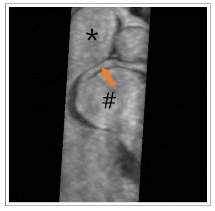 https://cdn.ncbi.nlm.nih.gov/pmc/blobs/83c7/9604894/13ca64d51769/jcdd-09-00361-g011.jpg