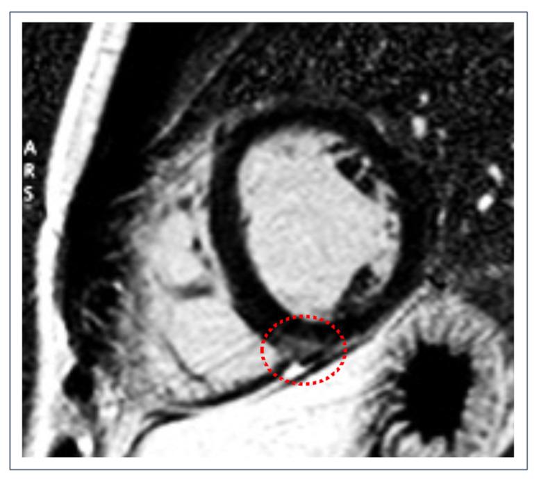 https://cdn.ncbi.nlm.nih.gov/pmc/blobs/83c7/9604894/4435ad286268/jcdd-09-00361-g001.jpg