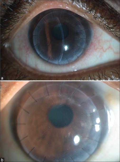 https://cdn.ncbi.nlm.nih.gov/pmc/blobs/83c8/11831948/096ba2564839/IJO-73-83-g005.jpg
