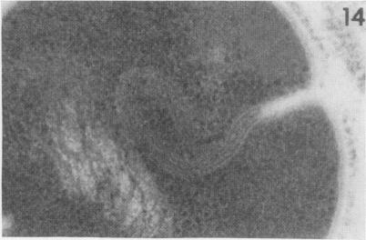 https://cdn.ncbi.nlm.nih.gov/pmc/blobs/83cb/415930/2ac401aa1636/iai00293-0070-e.jpg