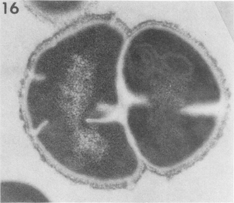 https://cdn.ncbi.nlm.nih.gov/pmc/blobs/83cb/415930/8c93390e9a90/iai00293-0070-g.jpg