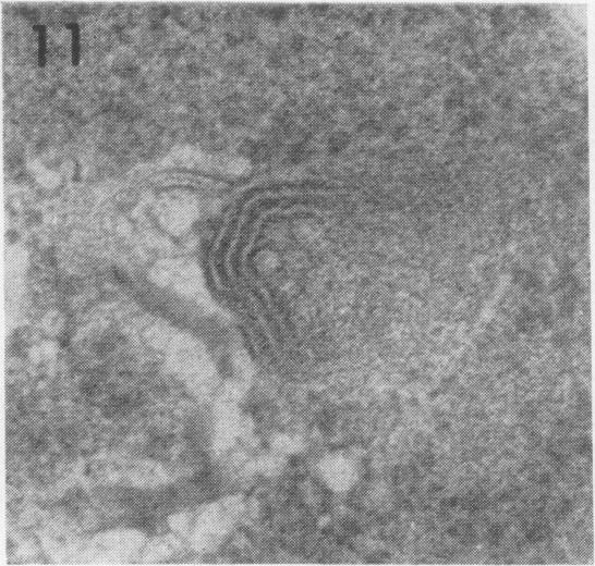 https://cdn.ncbi.nlm.nih.gov/pmc/blobs/83cb/415930/95a5397af962/iai00293-0070-b.jpg