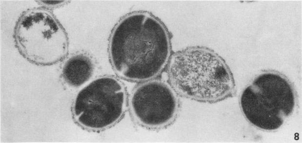 https://cdn.ncbi.nlm.nih.gov/pmc/blobs/83cb/415930/f8c57a99382b/iai00293-0069-b.jpg