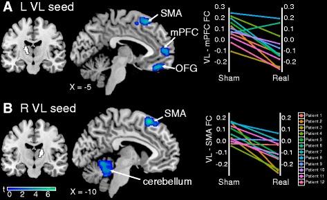 https://cdn.ncbi.nlm.nih.gov/pmc/blobs/83cf/4741001/0e01f25bcb63/13075_2016_934_Fig4_HTML.jpg