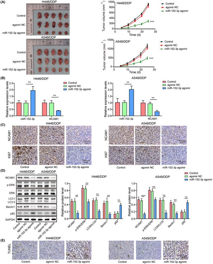 https://cdn.ncbi.nlm.nih.gov/pmc/blobs/83d6/10236622/237dfc5d7be9/CAS-114-2650-g005.jpg