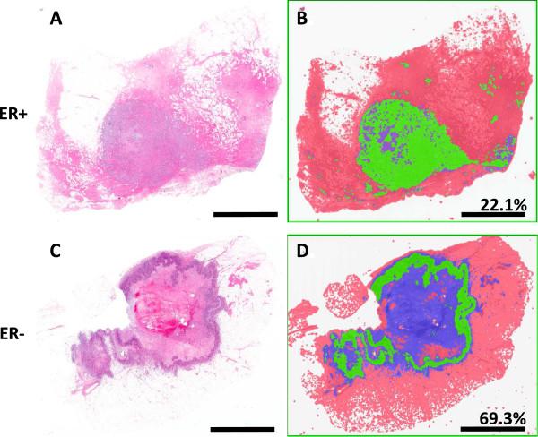 https://cdn.ncbi.nlm.nih.gov/pmc/blobs/83d6/4012762/17f06696c865/1471-2407-14-279-3.jpg