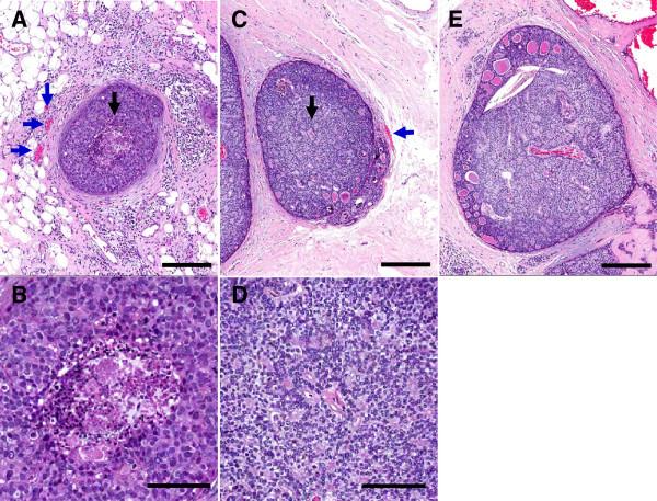https://cdn.ncbi.nlm.nih.gov/pmc/blobs/83d6/4012762/9580189dd01d/1471-2407-14-279-4.jpg