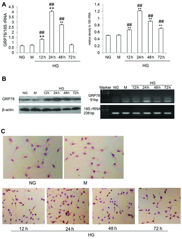 https://cdn.ncbi.nlm.nih.gov/pmc/blobs/83de/3976130/049c47d5f1af/IJMM-33-04-0809-g01.jpg