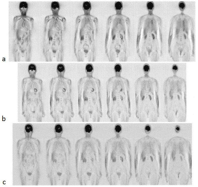 https://cdn.ncbi.nlm.nih.gov/pmc/blobs/83e6/8700072/1b88e3e5bb5f/diagnostics-11-02234-g005.jpg