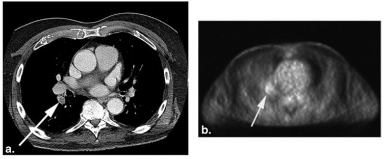 https://cdn.ncbi.nlm.nih.gov/pmc/blobs/83e6/8700072/2c349ac06a37/diagnostics-11-02234-g004.jpg
