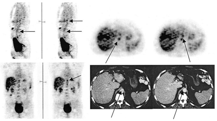 https://cdn.ncbi.nlm.nih.gov/pmc/blobs/83e6/8700072/944c9d0e5c53/diagnostics-11-02234-g001.jpg