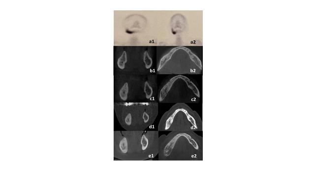 https://cdn.ncbi.nlm.nih.gov/pmc/blobs/83f1/10243713/d3587a523fcd/ASC_57(1)_62-69-f5.jpg
