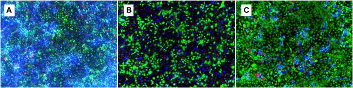 https://cdn.ncbi.nlm.nih.gov/pmc/blobs/83fa/11294919/2076ac82304f/fphar-15-1394053-g007.jpg
