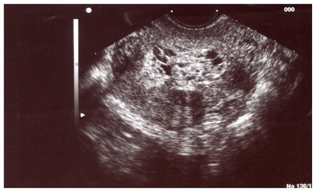 https://cdn.ncbi.nlm.nih.gov/pmc/blobs/83fa/3430087/c8690a856b3e/ijwh-4-423f2.jpg