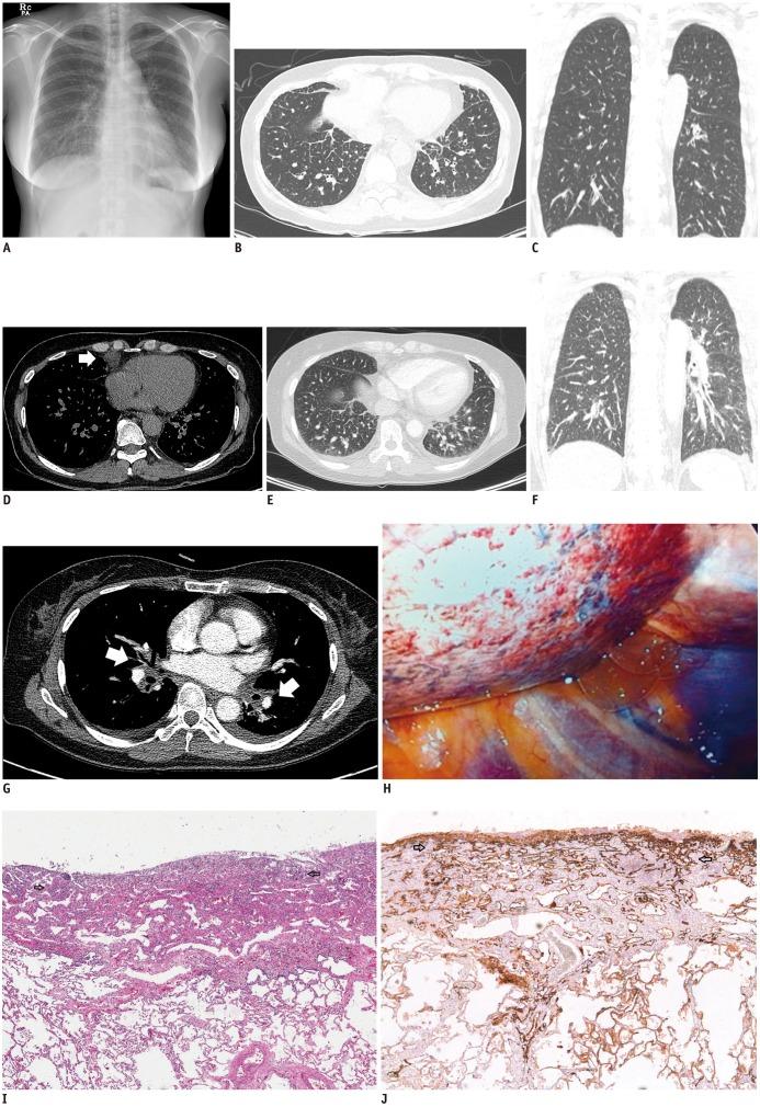 https://cdn.ncbi.nlm.nih.gov/pmc/blobs/83fb/3955798/724527a6fc23/kjr-15-295-g001.jpg