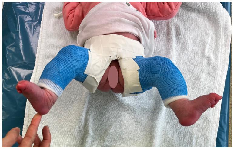 https://cdn.ncbi.nlm.nih.gov/pmc/blobs/83fb/9318343/521b5baa8880/children-09-01010-g002.jpg