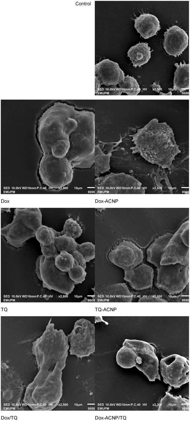 https://cdn.ncbi.nlm.nih.gov/pmc/blobs/8401/6617642/fd200d1fcedf/fonc-09-00599-g0006.jpg
