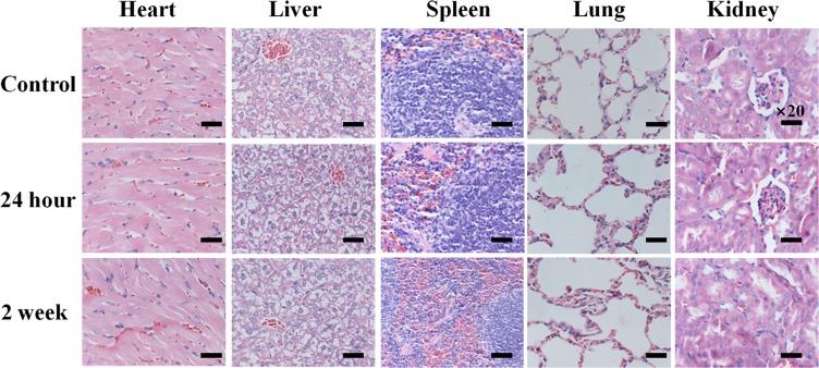https://cdn.ncbi.nlm.nih.gov/pmc/blobs/8402/6969685/76fedfb03291/IJN-15-227-g0009.jpg