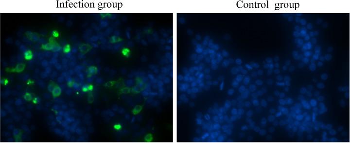 https://cdn.ncbi.nlm.nih.gov/pmc/blobs/8406/11534606/859ba14c0637/fcimb-14-1452158-g001.jpg