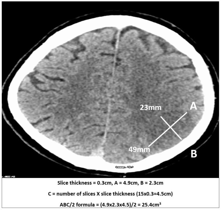 https://cdn.ncbi.nlm.nih.gov/pmc/blobs/840f/12190421/0cf8a045bf9d/brainsci-15-00560-g001.jpg