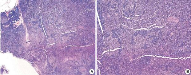 https://cdn.ncbi.nlm.nih.gov/pmc/blobs/840f/8743801/14fa6a6f3cd6/jptm-2021-09-29f7.jpg