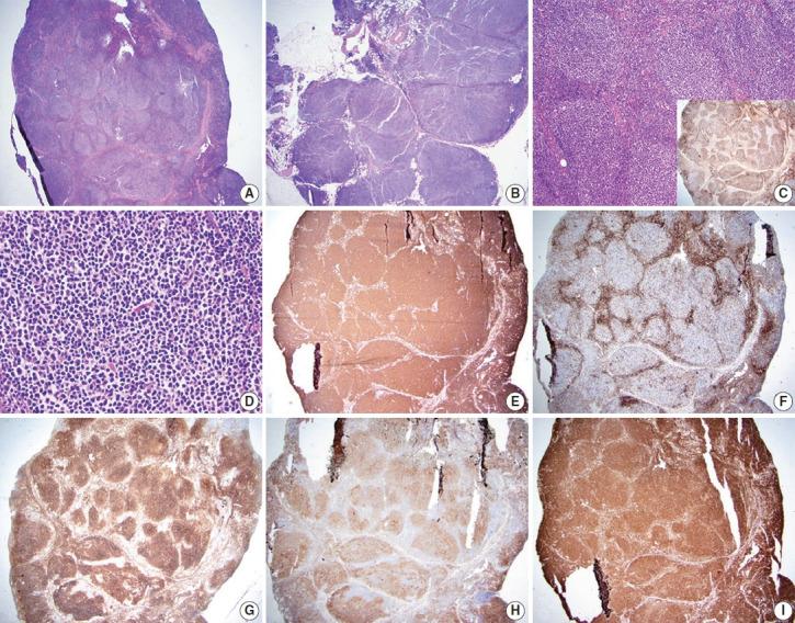 https://cdn.ncbi.nlm.nih.gov/pmc/blobs/840f/8743801/e528a79c26d2/jptm-2021-09-29f1.jpg