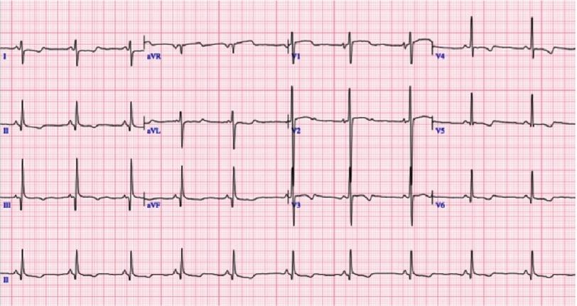 https://cdn.ncbi.nlm.nih.gov/pmc/blobs/8412/6209456/f10075d3c4b8/gcsp-2018-3-e201827-g002.jpg
