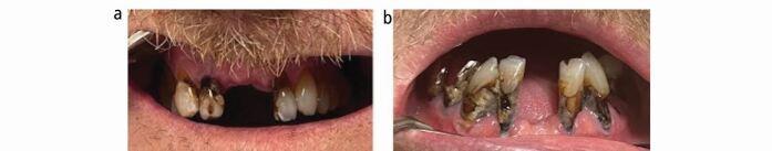 https://cdn.ncbi.nlm.nih.gov/pmc/blobs/8414/11549033/1d40966fa0ce/41415_2024_7894_Fig6_HTML.jpg