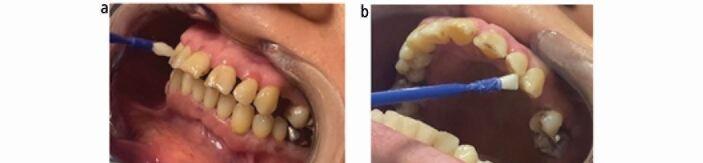 https://cdn.ncbi.nlm.nih.gov/pmc/blobs/8414/11549033/87decb40f08a/41415_2024_7894_Fig3_HTML.jpg