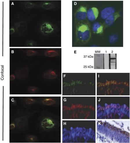 https://cdn.ncbi.nlm.nih.gov/pmc/blobs/8416/2359975/087270d00e3d/6603818f3.jpg